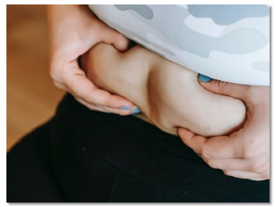 Tummy Tuck Surgery in Mumbai