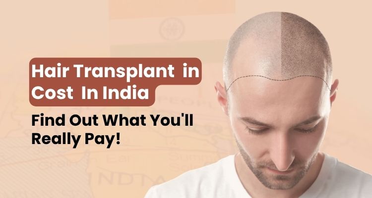 hair tansplant cost in india