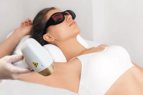 laser hair removal