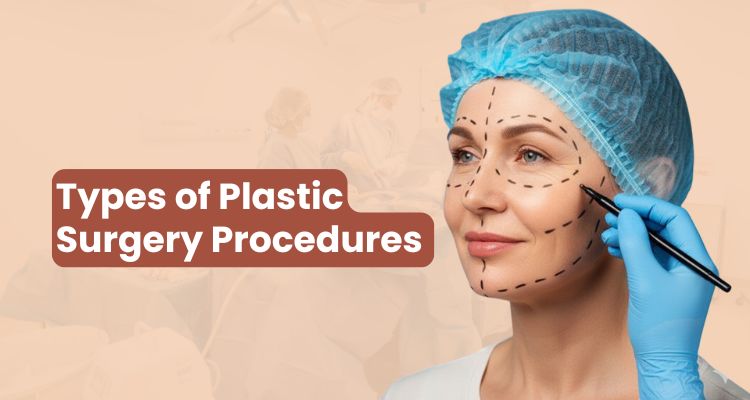 Types of Plastic Surgery Procedures