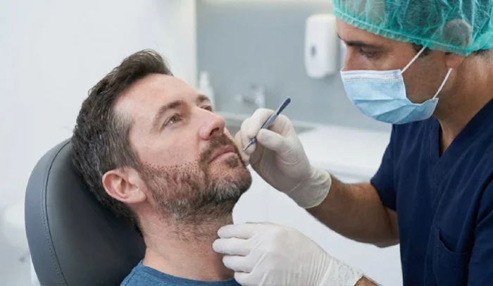 Beard Hair Transplant in Mumbai
