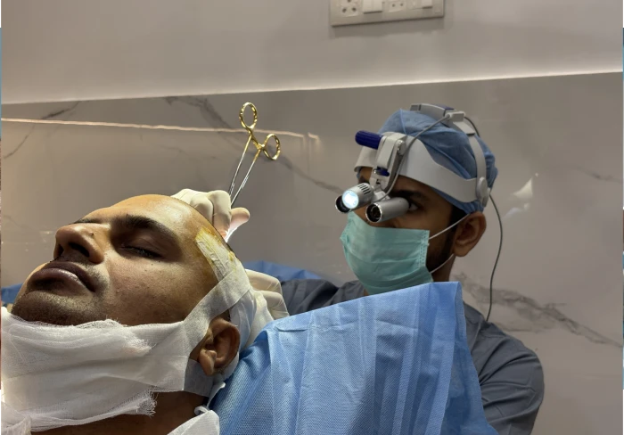 FUE Hair Transplant in Mumbai fue hair transplant in mumbai