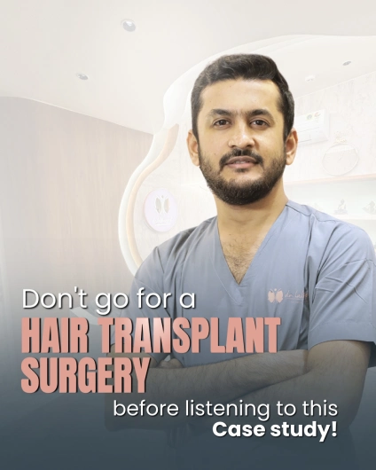 Hair transplant surgery before listening to this case study