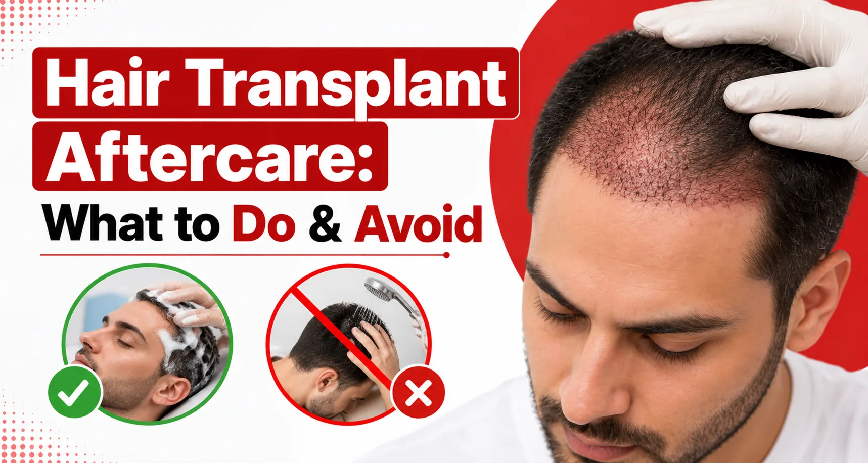 Hair Transplant Aftercare: What to Do & Avoid
