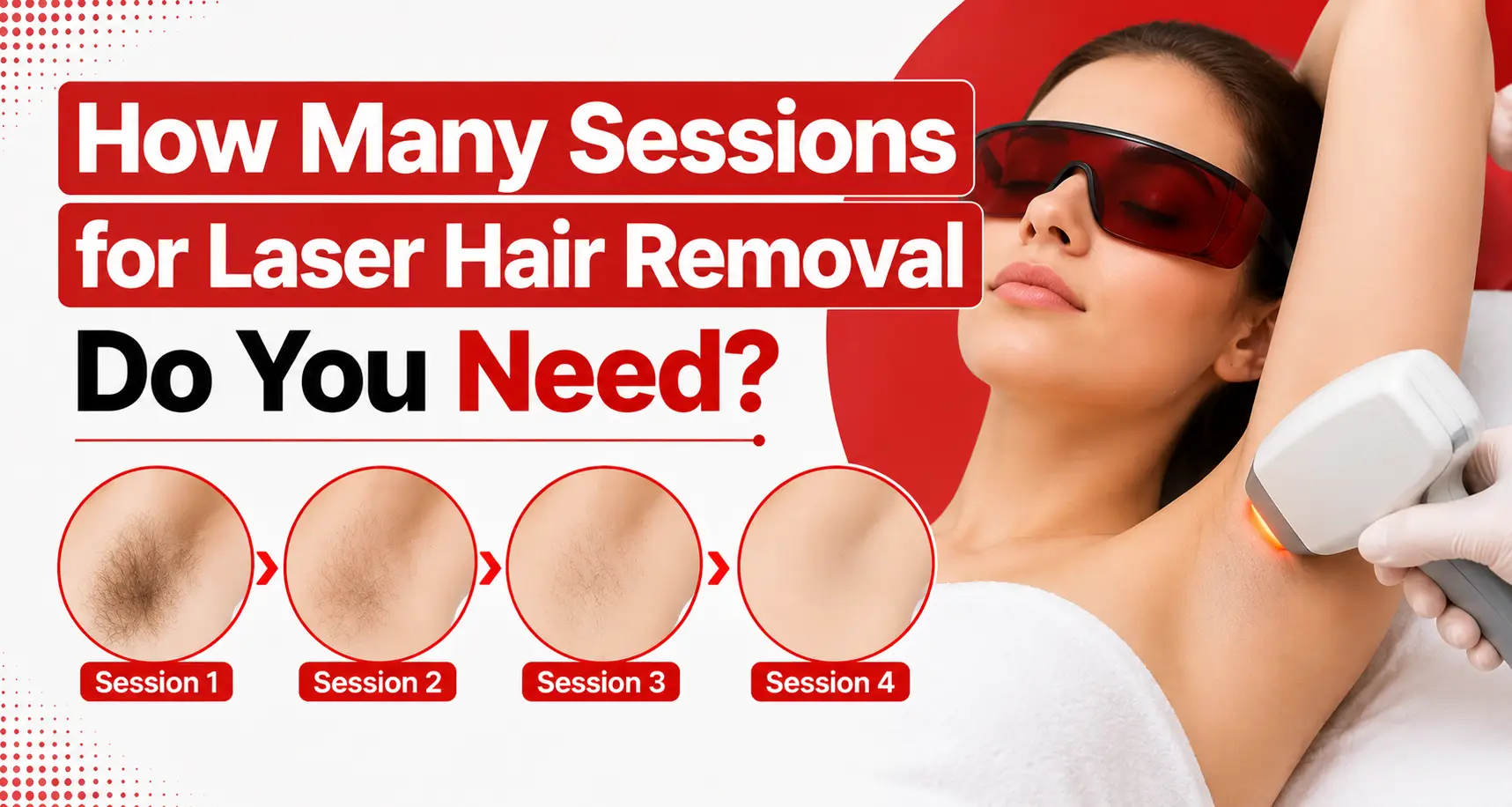 How Many Sessions for Laser Hair Removal Do You Need?