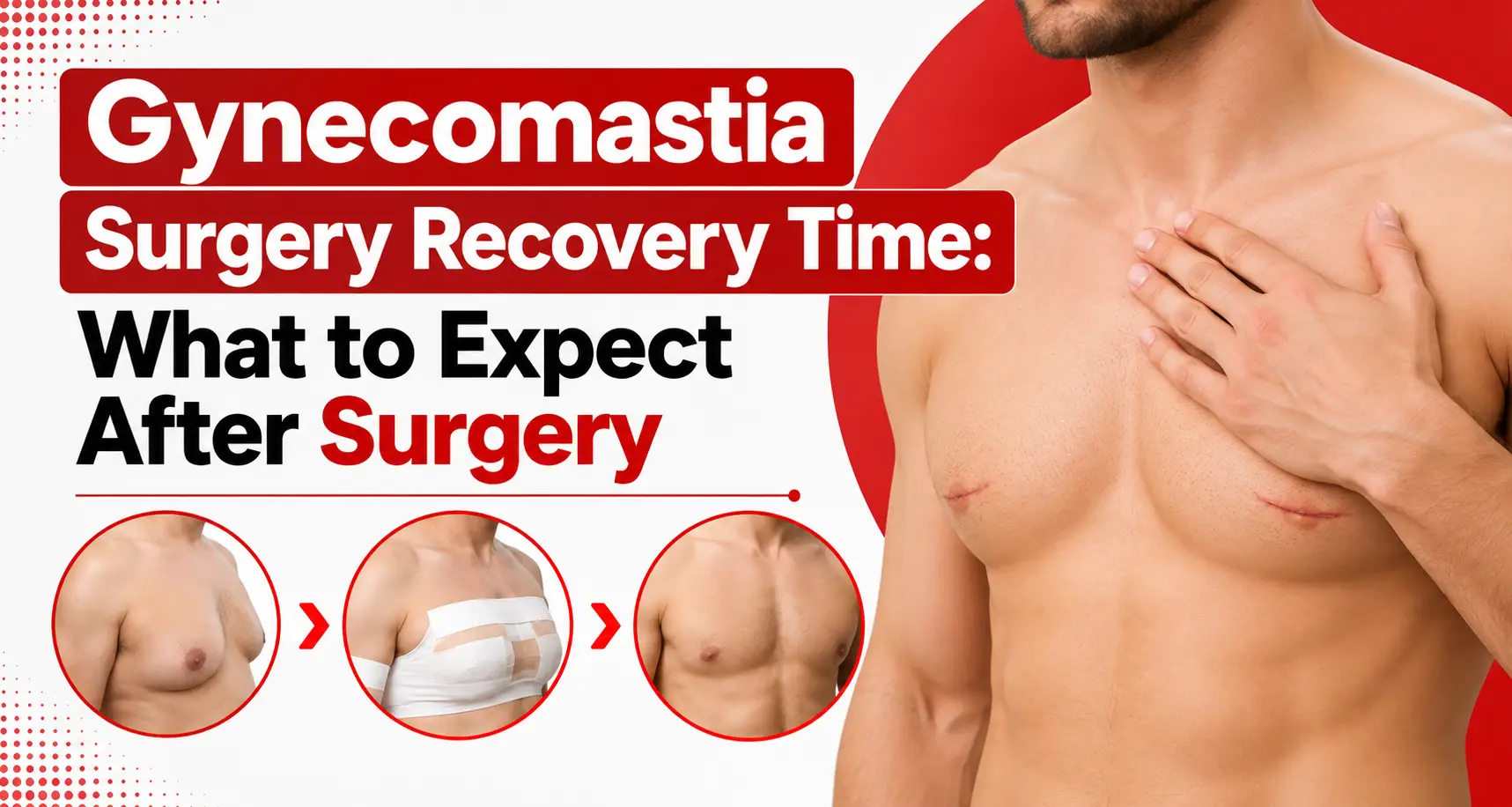 gynecomastia surgery recovery time